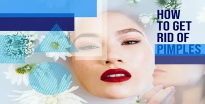 How to Get Rid of Pimples?
